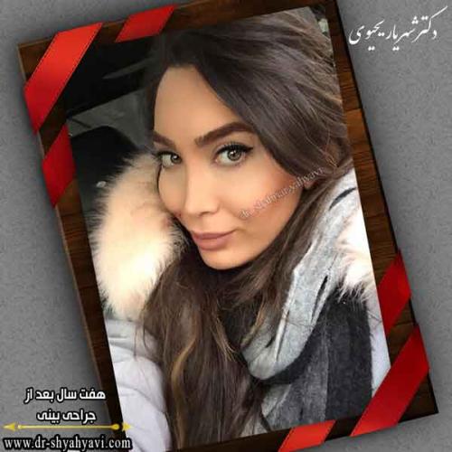 جراحی بینی 402