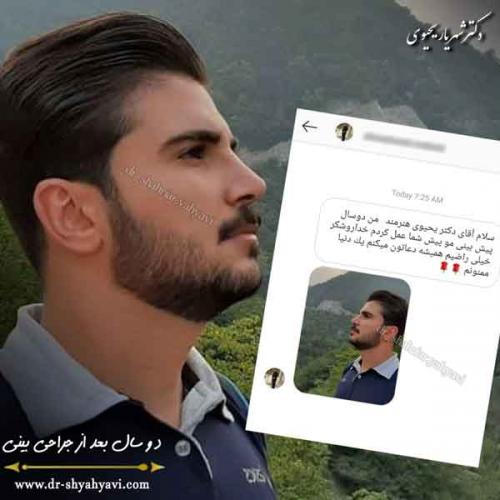 جراحی بینی 404