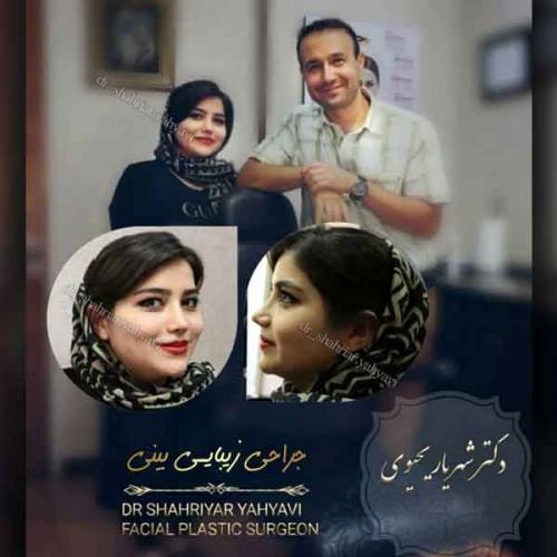 جراحی بینی 406