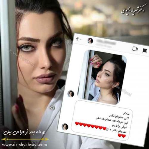 جراحی بینی 407