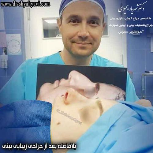 جراحی بینی 410