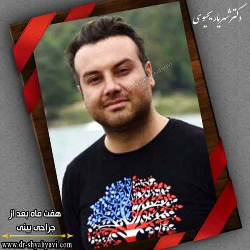 جراحی بینی 411