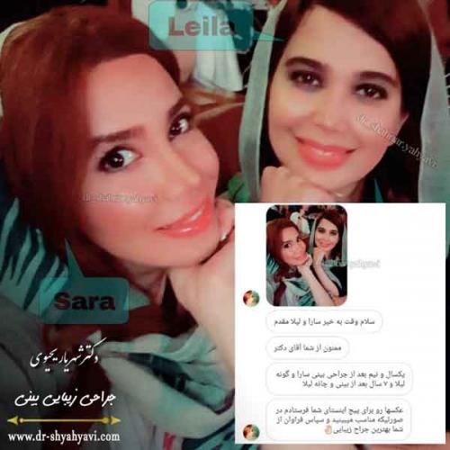 جراحی بینی 412