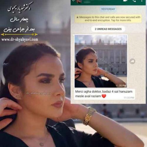 جراحی بینی 414