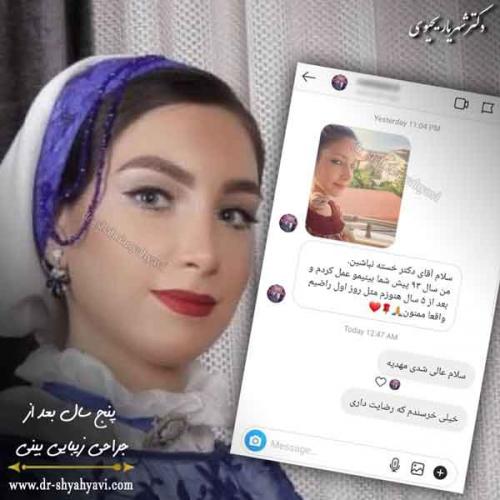 جراحی بینی 417