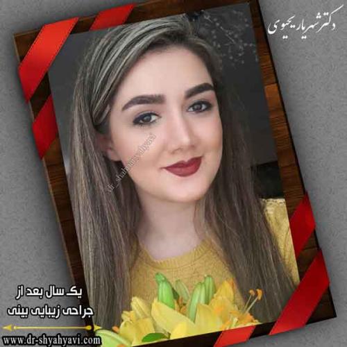 جراحی بینی 418