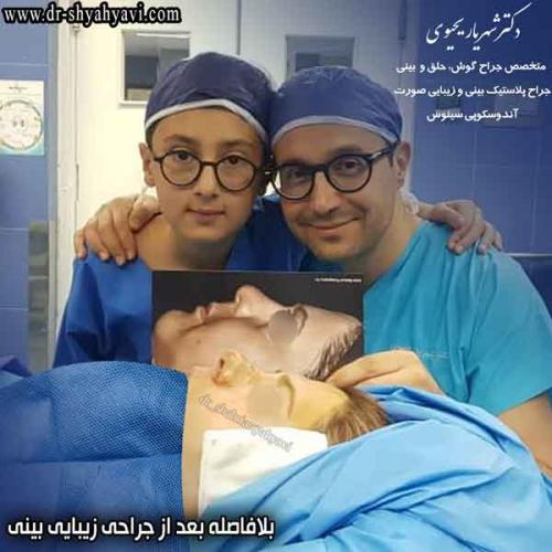 جراحی بینی 419