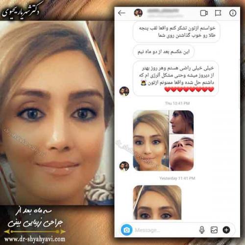 جراحی بینی 420