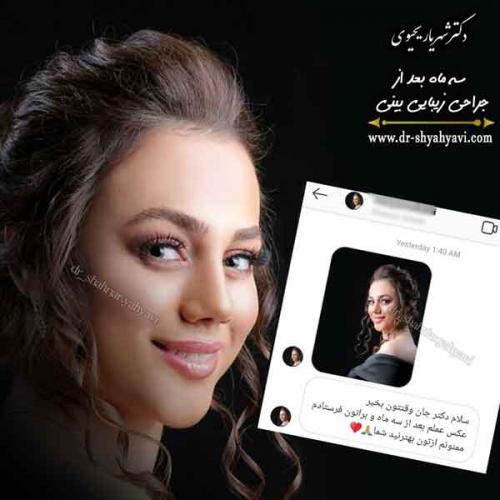 جراحی بینی 422