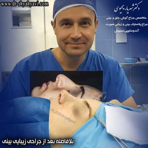 جراحی بینی 426