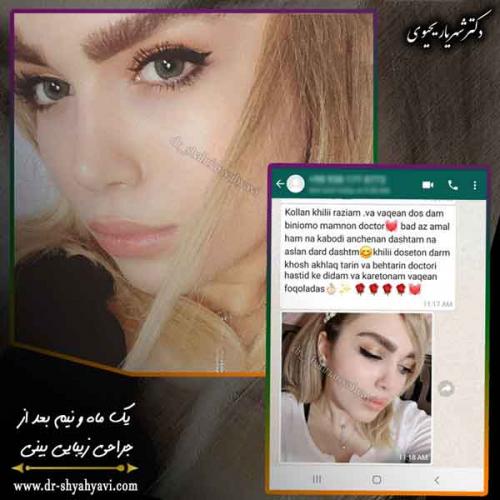 جراحی بینی 427