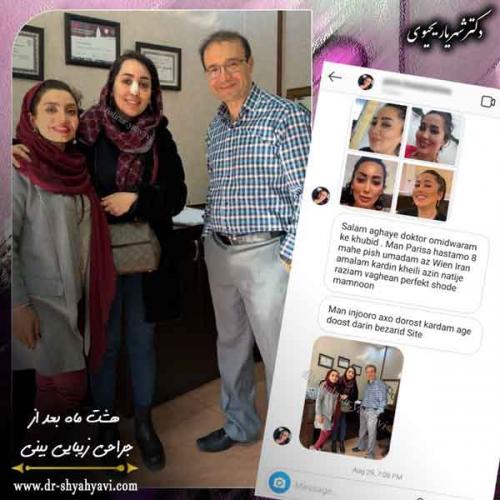 جراحی بینی 429