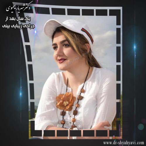 جراحی بینی 431